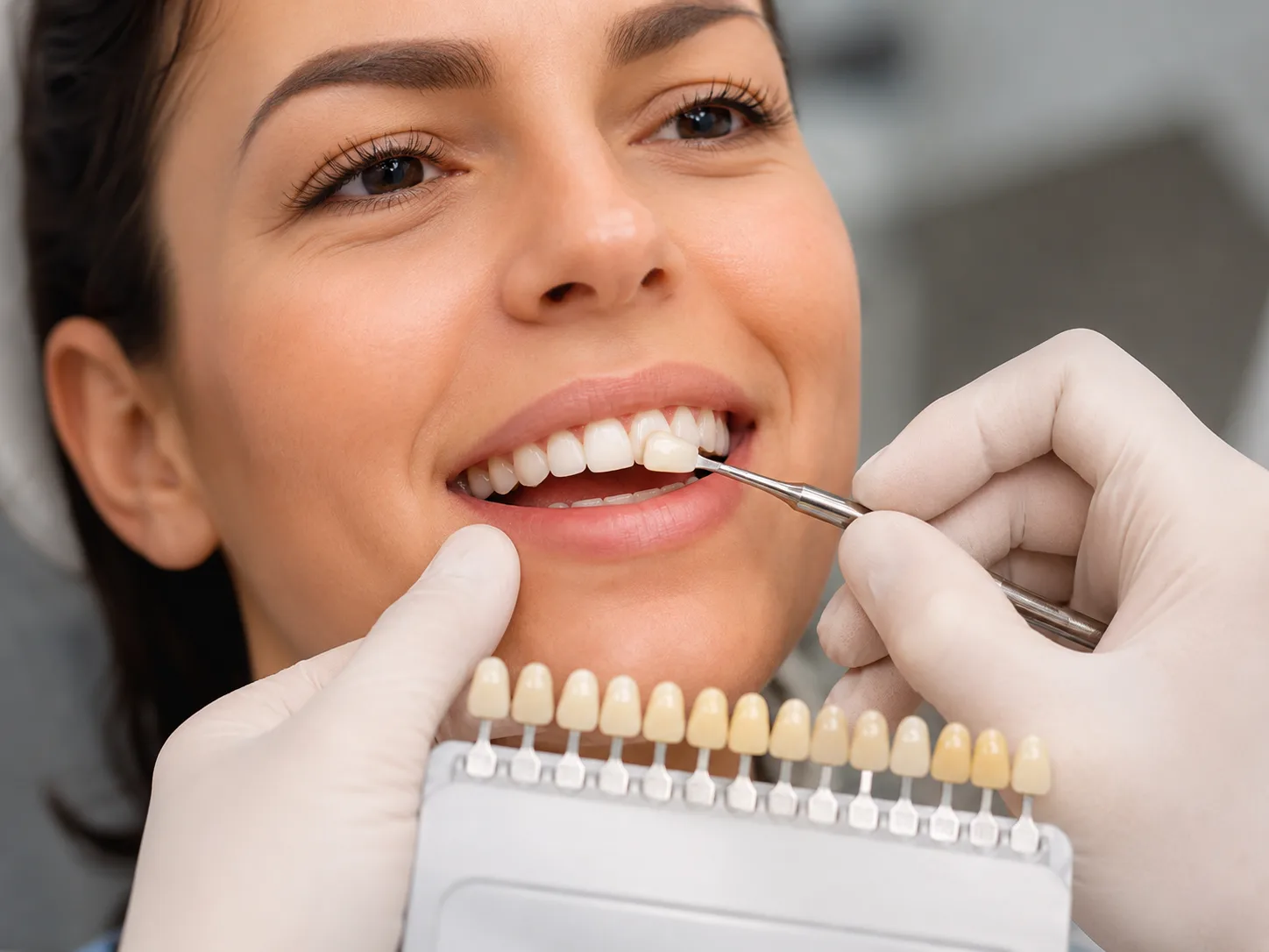 Procedimento de estética dental sendo realizado na MySmile Dental